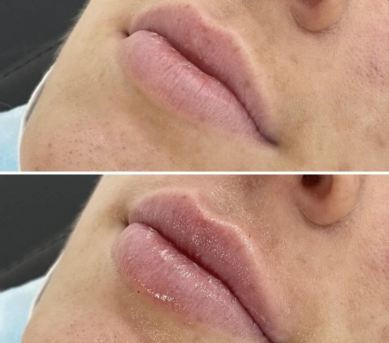 Before & After — NCTF & Quench