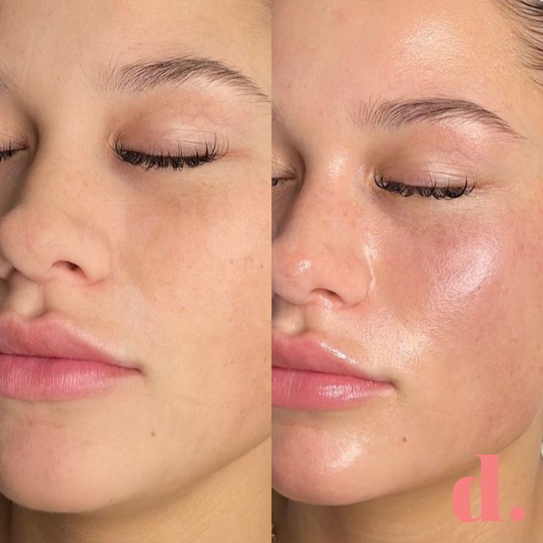 Before & After — DiamondGlow