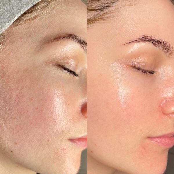 Before & After — DiamondGlow