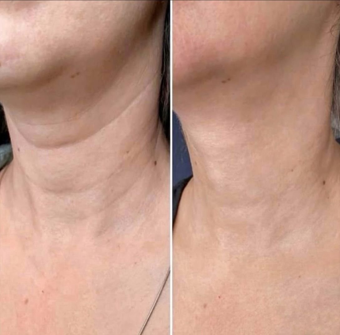 Signature Elite Facial Treatment