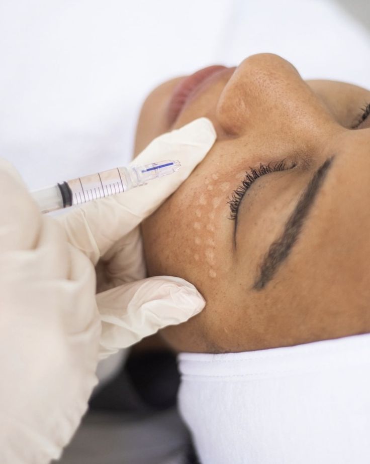 Skin Booster Treatment