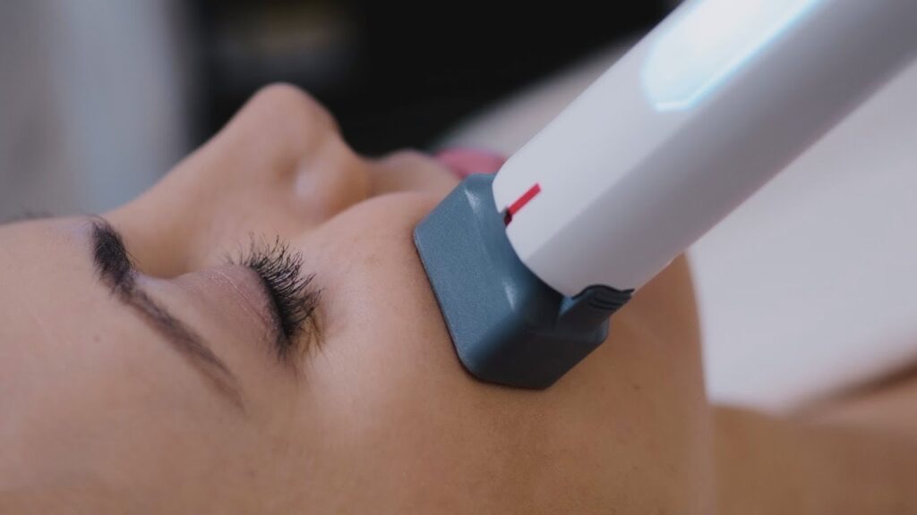 XERF Skin Tightening