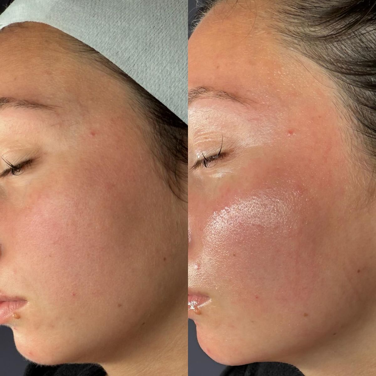 Soin DiamondGlow Microdermabrasion
